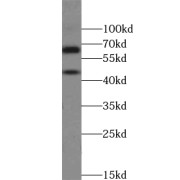 WB analysis of K-562 cells, using UCKL1 antibody (1/300 dilution).