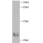 WB analysis of rat skin, using UCN2 antibody (1/1000 dilution).