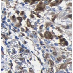 UTP Glucose-1-Phosphate Uridylyltransferase (UGP2) Antibody