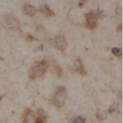 2-Hydroxyacylsphingosine 1-Beta-Galactosyltransferase (UGT8) Antibody