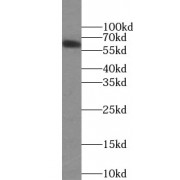 WB analysis of rat brain tissue, using UGT8 antibody (1/1000 dilution).