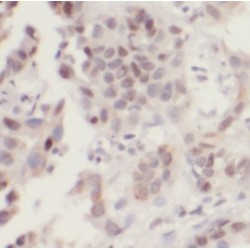 Ubiquitin Like With PHD And Ring Finger Domains 1 (UHRF1) Antibody