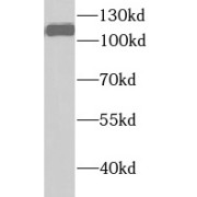WB analysis of HeLa cells, using UHRF1 antibody (1/1000 dilution).