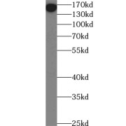 WB analysis of mouse brain tissue, using UHRF1BP1L antibody (1/1500 dilution).