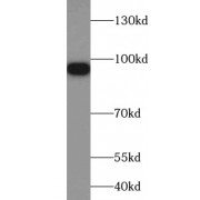 WB analysis of mouse brain tissue, using UNC5A-Specific antibody (1/100 dilution).