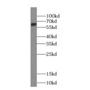 WB analysis of mouse kidney tissue, using UNC5D-Specific antibody (1/500 dilution).