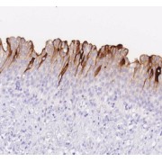 IHC-P analysis of human bladder tissue, using UPK1A Antibody (1/100 dilution).