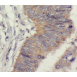 Cytochrome B-C1 Complex Subunit 2, Mitochondrial (UQCRC2) Antibody