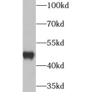 WB analysis of mouse brain tissue, using UQCRC2 antibody (1/1000 dilution).