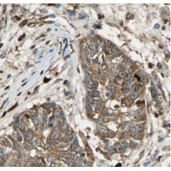 Uroporphyrinogen III Synthase (UROS) Antibody