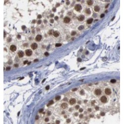 Ubiquitin Carboxyl-Terminal Hydrolase 13 (USP13) Antibody