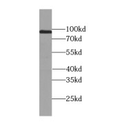 WB analysis of HepG2 cells, using USP13 antibody (1/1000 dilution).