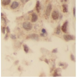 Ubiquitin Carboxyl-Terminal Hydrolase 28 (USP28) Antibody