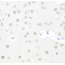 U3 Small Nucleolar RNA-Associated Protein 14 Homolog A (UTP14A) Antibody