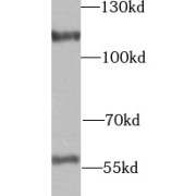 WB analysis of mouse brain tissue, using UTP14A antibody (1/1000 dilution).