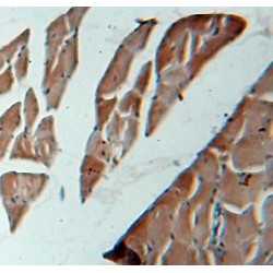Vesicle-Associated Membrane Protein 2 (VAMP2) Antibody
