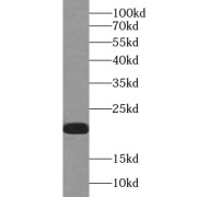 WB analysis of mouse brain tissue, using VAMP7 antibody (1/1000 dilution).