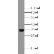 WB analysis of human kidney tissue, using VAPA antibody (1/500 dilution).