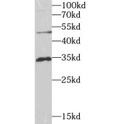 WB analysis of HeLa cells, using VAPB antibody (1/1000 dilution).