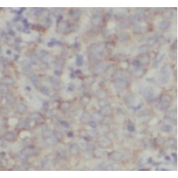Vesicle-Associated Membrane Protein-Associated Protein B/C (VAPB) Antibody