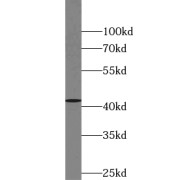 WB analysis of human brain tissue, using VASH1 antibody (1/500 dilution).