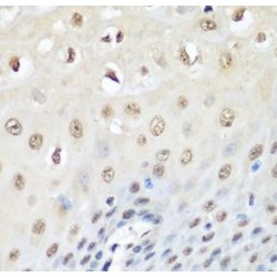 Transitional Endoplasmic Reticulum ATPase (VCP) Antibody