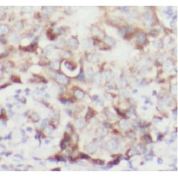 Deubiquitinating Protein VCIP135 (VCPIP1) Antibody
