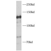 WB analysis of MCF7 cells, using VCPIP1 antibody (1/500 dilution).
