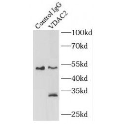 Voltage-Dependent Anion-Selective Channel Protein 2 (VDAC2) Antibody