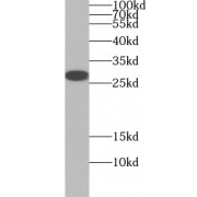 WB analysis of PC-3 cells, using VEGFA antibody (1/800 dilution).