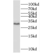 WB analysis of Reocmbinant proteins, using VGLL4 antibody (1/1000 dilution).