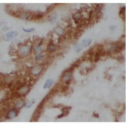 Von Hippel-Lindau Disease Tumor Suppressor (VHL) Antibody