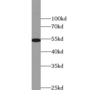 WB analysis of NIH/3T3 cells, using VIM antibody (1/1000 dilution).