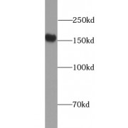 WB analysis of MCF7 cells, using VLDLR antibody (1/300 dilution).