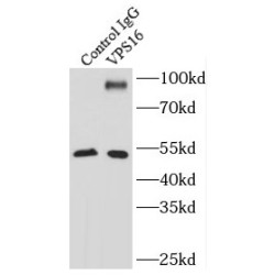 Vacuolar Protein Sorting-Associated Protein 16 Homolog (VPS16) Antibody