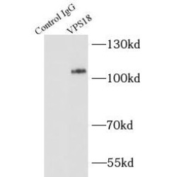 Vacuolar Protein Sorting-Associated Protein 18 Homolog (VPS18) Antibody