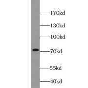 WB analysis of mouse testis tissue, using VPS33B antibody (1/500 dilution).