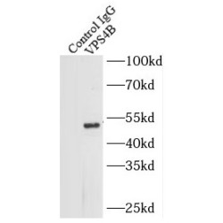 Vacuolar Protein Sorting-Associated Protein 4B (VPS4B) Antibody