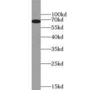WB analysis of K-562 cells, using VRK2 antibody (1/500 dilution).
