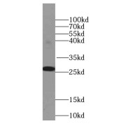 WB analysis of Recombinant proteins, using VSTM2L antibody (1/1000 dilution).