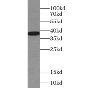 WB analysis of human kidney tissue, using VTA1 antibody (1/500 dilution).