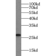 WB analysis of human liver tissue, using VTI1B antibody (1/1000 dilution).