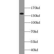 WB analysis of HL-60 cells, using WAPL; WAPAL antibody (1/300 dilution).
