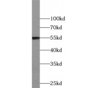 WB analysis of human liver tissue, using WARS2 antibody (1/500 dilution).