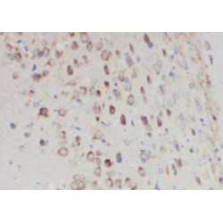 Putative Polypeptide N-Acetylgalactosaminyltransferase-Like Protein 3 (WBSCR17) Antibody