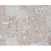 abx239479