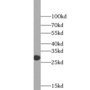 WB analysis of HeLa cells, using WDR4 antibody (1/300 dilution).