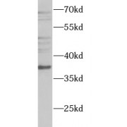 WB analysis of NIH/3T3 cells, using WDR5 antibody (1/1000 dilution).
