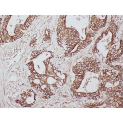 WD Repeat-Containing Protein 55 (WDR55) Antibody