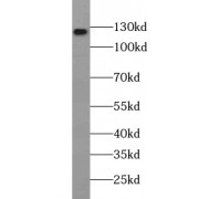 WB analysis of HeLa cells, using WDR6 antibody (1/500 dilution).